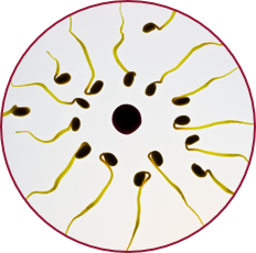 Meddőség tünetei: spermiumok vagy petesejt útjának blokádja