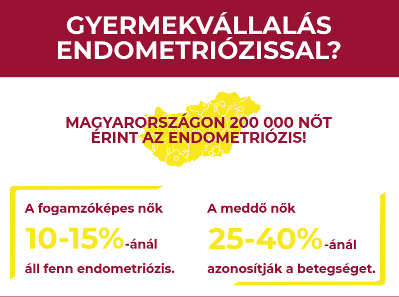 endometriózis infografika - Intima.hu