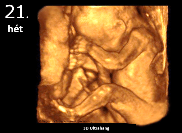 Terhesség 21. hét - Nagyobb képért kattints ide!